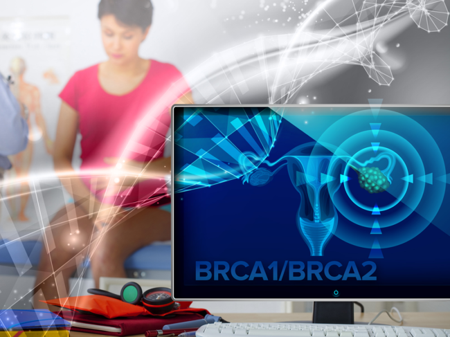 Concept art of DNA, BRCA1/BRCA2 associated ovarian cancer.